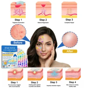 Celsiora® 2-in-1 Microneedle & Hydrocolloid Star Patch | Acne, Raised Moles, Flat Warts & Skin Tags Remover | 6 Colors Pimple Patch for Face & Neck | Invisible Star Zit Stickers | 240 Count