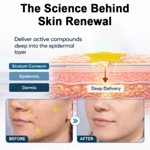 Celsiora® 2-in-1 Microneedle & Hydrocolloid Star Patch | Acne, Raised Moles, Flat Warts & Skin Tags Remover | 6 Colors Pimple Patch for Face & Neck | Invisible Star Zit Stickers | 240 Count