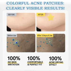 Celsiora® 2-in-1 Microneedle & Hydrocolloid Star Patch | Acne, Raised Moles, Flat Warts & Skin Tags Remover | 6 Colors Pimple Patch for Face & Neck | Invisible Star Zit Stickers | 240 Count
