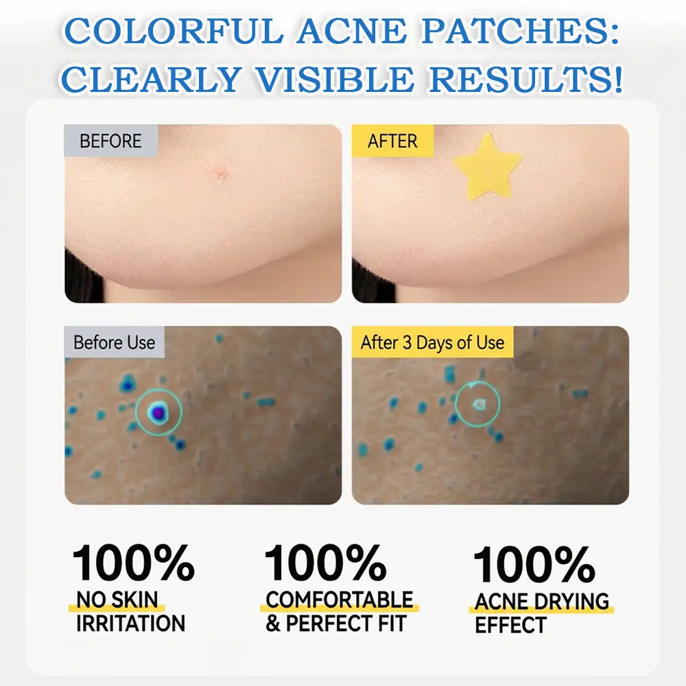Celsiora® 2-in-1 Microneedle & Hydrocolloid Star Patch | Acne, Raised Moles, Flat Warts & Skin Tags Remover | 6 Colors Pimple Patch for Face & Neck | Invisible Star Zit Stickers | 240 Count